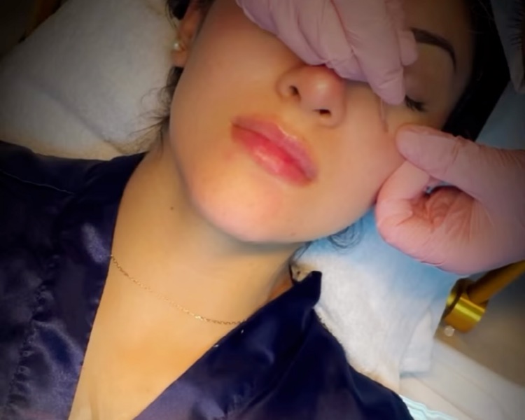Sesión de limpieza facial publicada por Bella Naturale